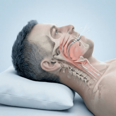 Levora Pro Wirkungsweise Diagramm